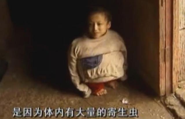 奇闻:14岁男孩生吃鸡鸭,举止行为像动物,检查医生都蒙了!