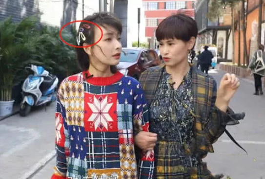 吴昕莫名带火“五彩发夹”，比珍珠发夹时髦多了，成小仙女新宠！