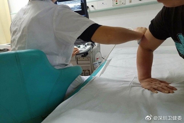 拧毛巾都手疼？你可能患上“家庭主妇肘”
