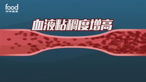 养护血管的最佳时机就是现在