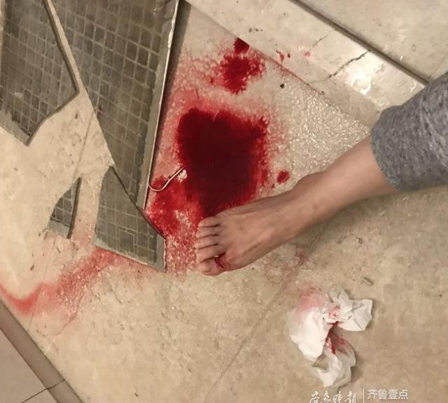 淄博：喜来登酒店浴室瓷砖脱落致使住客右脚受伤