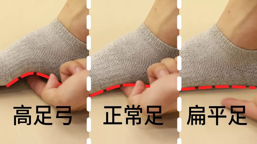 走路袜子老掉怎么办?最后一招你绝对想不到