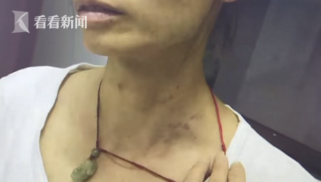 为了一套新内衣男子疯狂殴打妻子 女儿报警民警劝架也被打