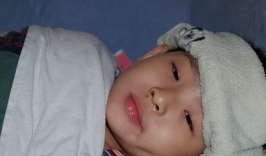 孩子半夜发烧，家长该用热毛巾还是冷毛巾敷？很少人知道，别弄错