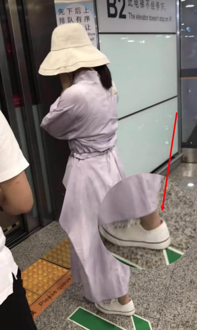 赵丽颖拒被拍捂脸躲进电梯,脚跟磨破出血都顾不上处理