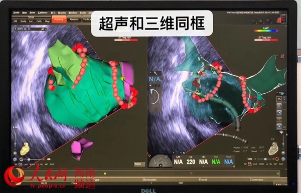 为使用特许进口器械 北京患者远赴博鳌超级医院手术