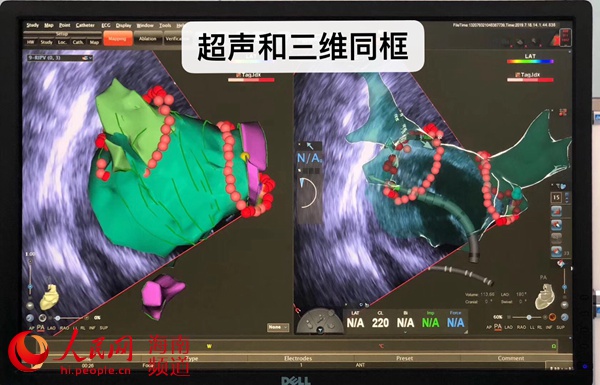 为使用特许进口器械 北京患者远赴博鳌超级医院手术