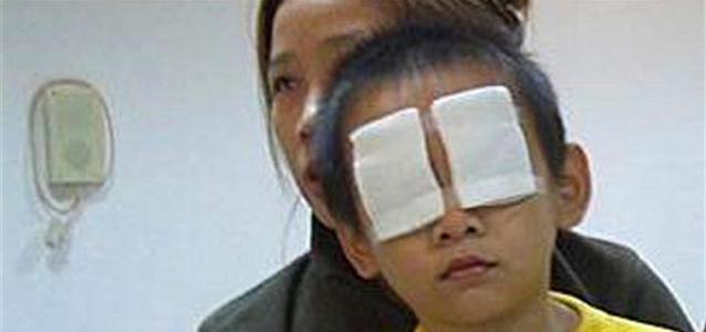 3岁儿子把石灰撒进眼睛，妈妈不敢用水洗，医生大骂无知