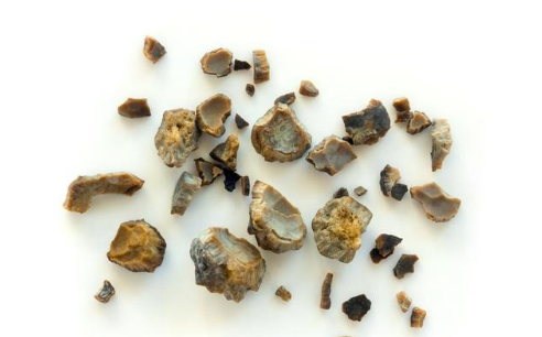 男人喝葡萄酒，有这5个好处，但要适量喝