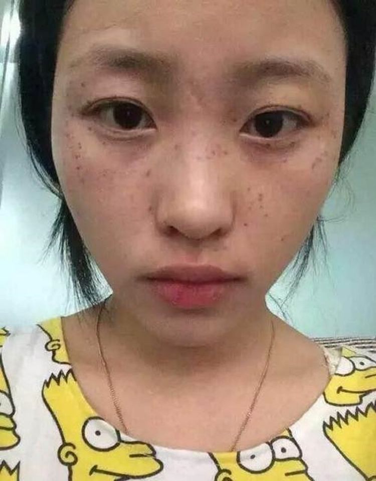 蜂蜜加它敷脸，坚持半个月明显淡斑，难怪被很多人强势安利了！