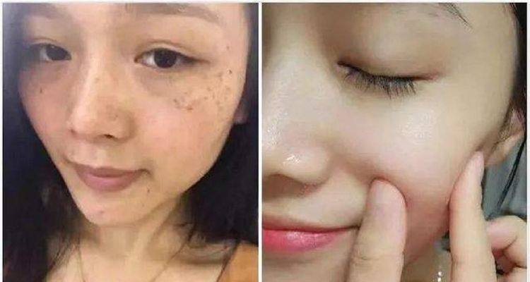 蜂蜜加它敷脸，坚持半个月明显淡斑，难怪被很多人强势安利了！
