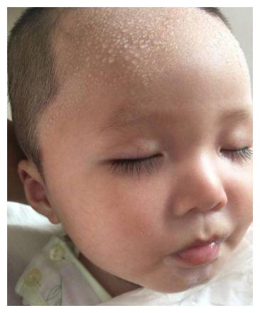 宝宝一睡觉就满头大汗？是脾虚了，做好3点，养护孩子的脾胃