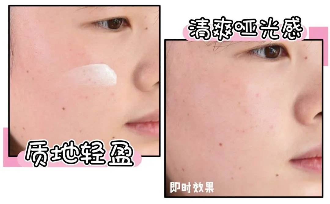 口罩戴出干燥、敏感、痘痘?来康康烂脸女孩都是怎么自救的!