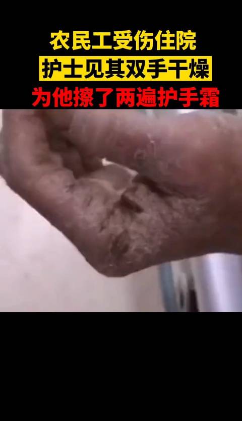 农民工受伤住院，护士见其双手干燥，为他擦了两遍护手霜...
